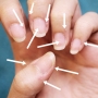 Projekt: Rescue the nails!