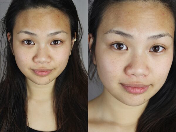 Garnier Hautklar Challenge | Das Fazit