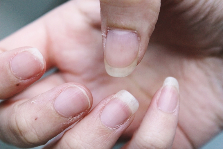 “Rescue the Nails” – Fail & Neustart | Update